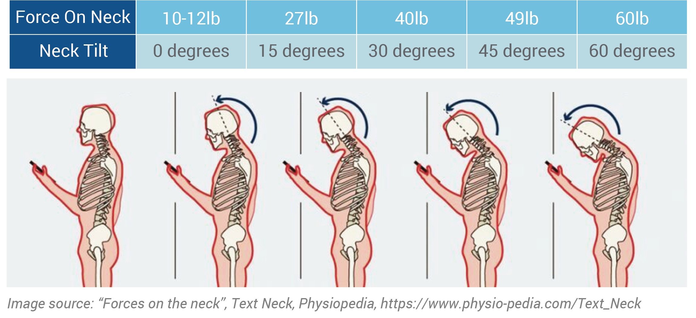 Neck-tilt