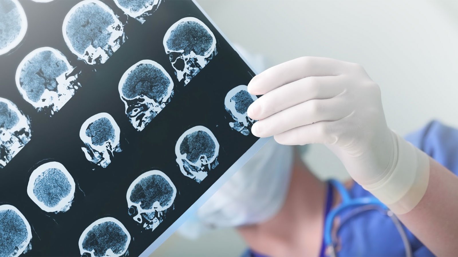 What is a Closed Head Injury?
