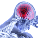 Loss or Blurred Vision After Head Injury: Types of Issues and What You Can Do