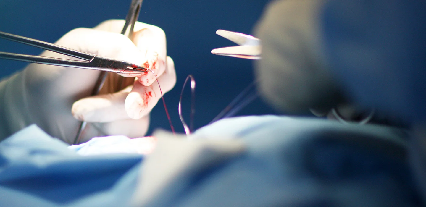 Suturing Image