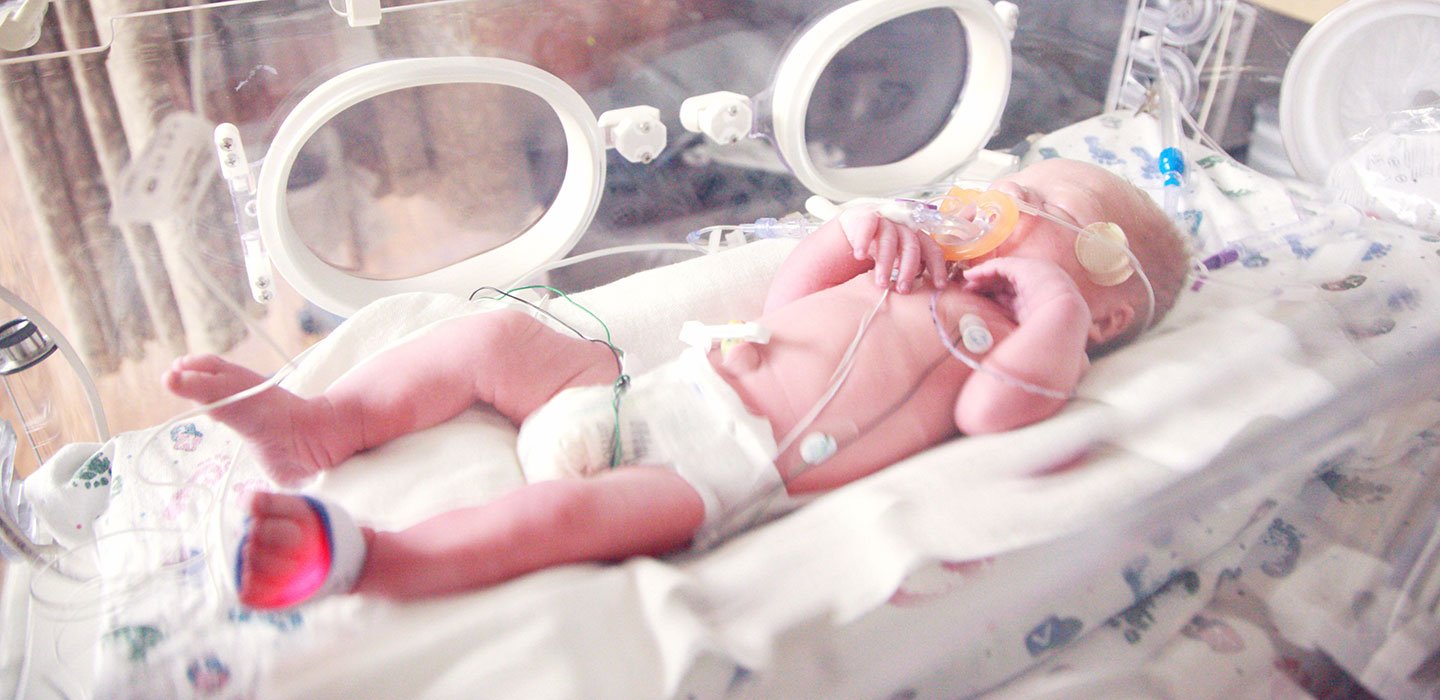 5 Signs Your Child Suffered a Preventable Birth Injury