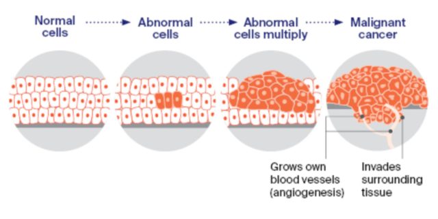 Cancer Cell Growth