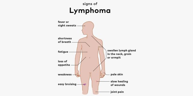 Lymphoma Symptoms