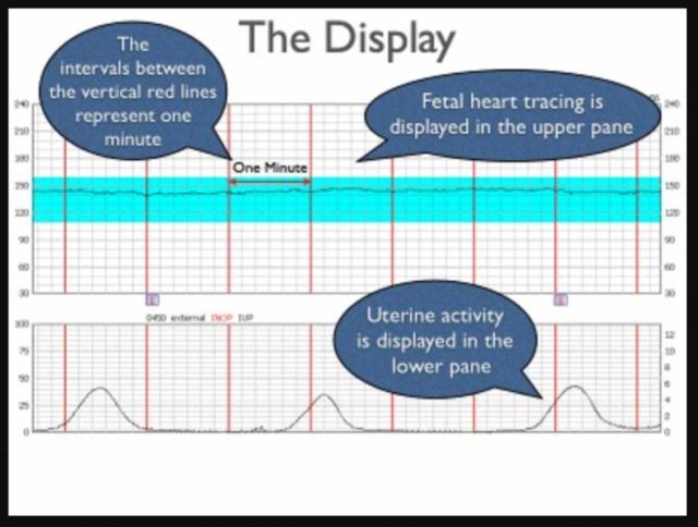 heart rate